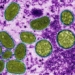 reasons why emergency renaming of disease should be implemented during 121107