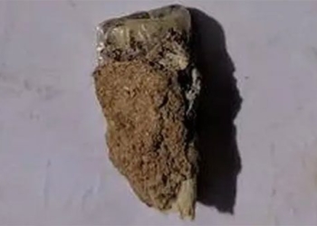 research finds human teeth with an age of 1 8 million years 122892