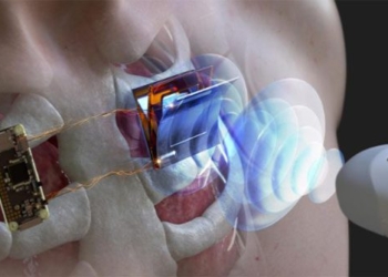 research new help battery implant heartbeat without surgery 120175