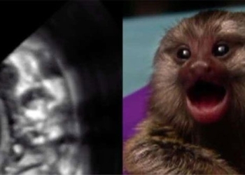 research new publication for mother when under shock call mom since in the womb 122202