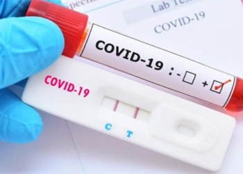 scientists develop new approaches to covid 19 cell health 120030