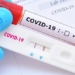 scientists develop new approaches to covid 19 cell health 120030