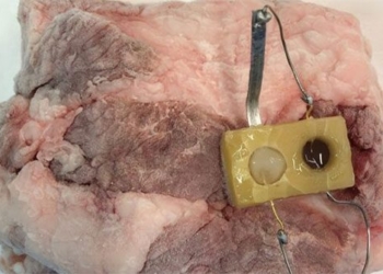 scientists develop sensors monitoring glucose levels in intestines 124590
