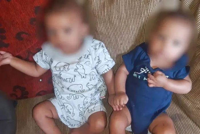 Twins with different fathers of the 19-year-old Brazilian mother.