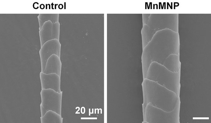 Hair regrowth in mice treated with the new microneedle patch