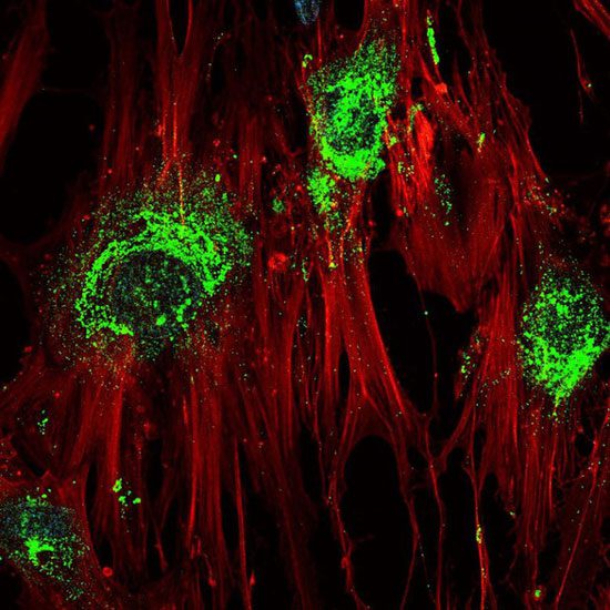 High-frequency sound waves can transform stem cells into bone cells