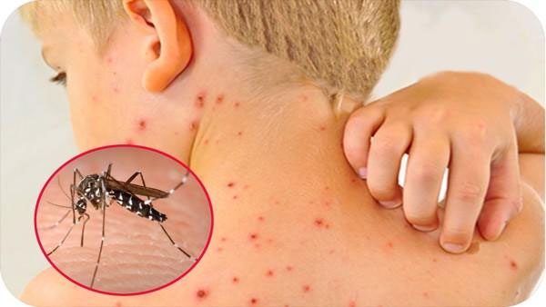 Fever is the body's reaction to pathogens