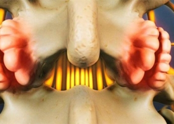 spinal cord injury dangerous conditions early detection 88532