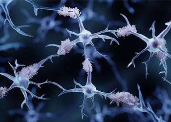 story color will open up a new hope in the treatment of alzheimers disease 121862