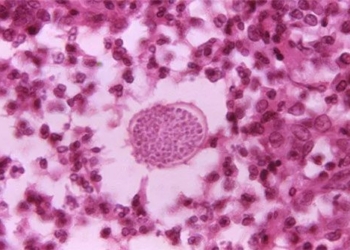 strange disease abdominal swelling in the southwestern us during hot dry weather 122689