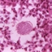 strange disease abdominal swelling in the southwestern us during hot dry weather 122689
