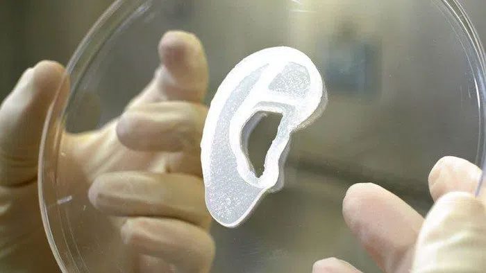Cells cultured into a "young ear" before being grafted onto the 3D print