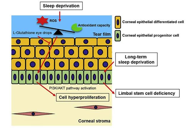 Sleep deprivation causes corneal epithelial stem cells to expand excessively