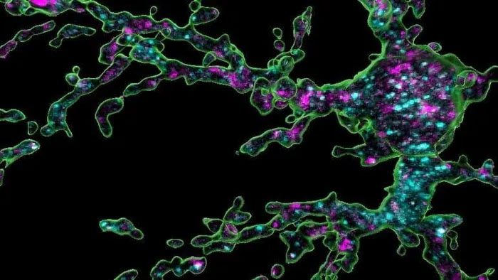 OPC cells (green)