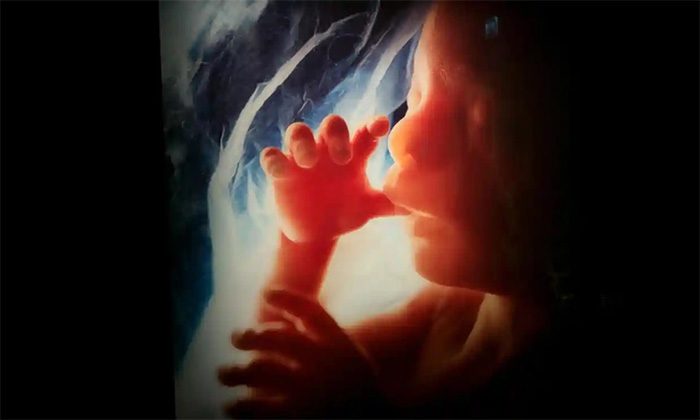 Toxic black carbon particles found in fetuses