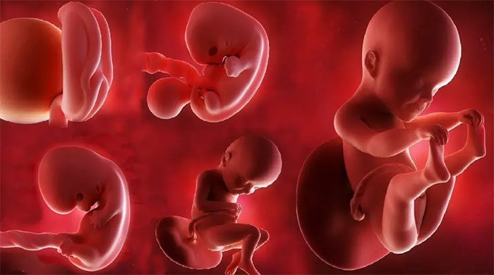 Fetus.