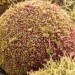 the first woman in the world to be cured of hiv thanks to stem cell therapy 118846