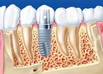 the history of the evolution and development of fake teeth 123126
