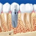 the history of the evolution and development of fake teeth 123126