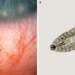 the horse never dies because of the population of organisms in the eye 119913