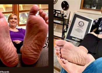 the woman with the largest feet in the world 124281