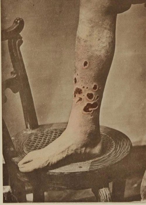 Many patients among them had symptoms that actually worsened.