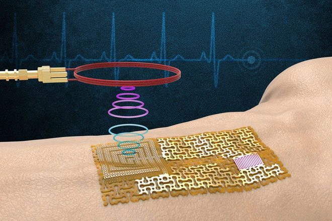 Minimalist wearable sensor without batteries or memory chips.