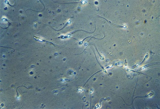 Most of these men did not experience severe Covid-19.