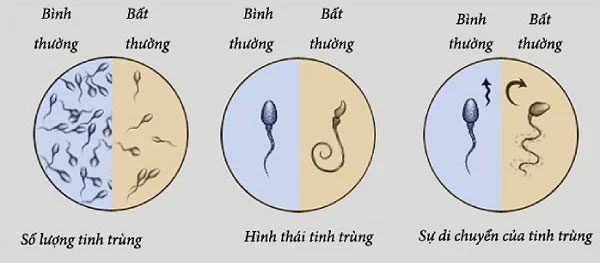 tinh trung suy giam