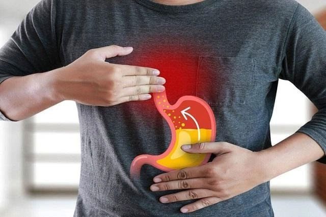Gastroesophageal reflux disease