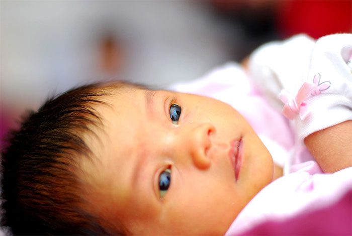 Jaundice and yellowing of the eyes are characteristic in children with hepatitis.