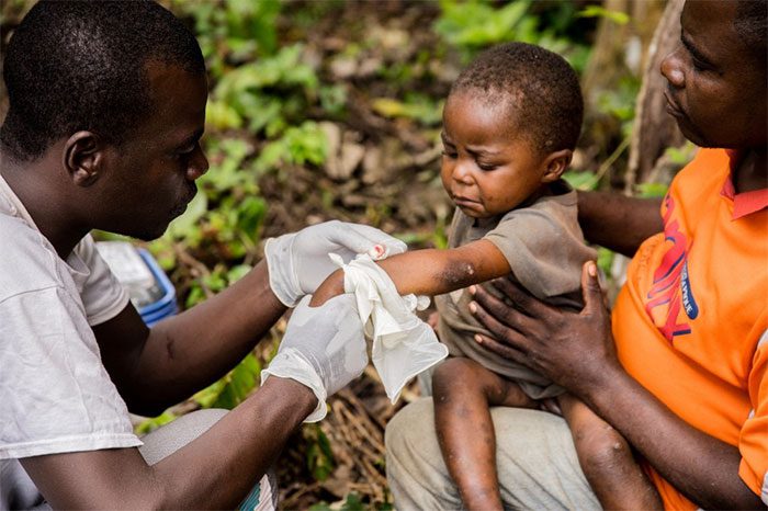 Healthcare workers treating a child with monkeypox in Zomea Kaka, Lobaya region, Central African Republic.