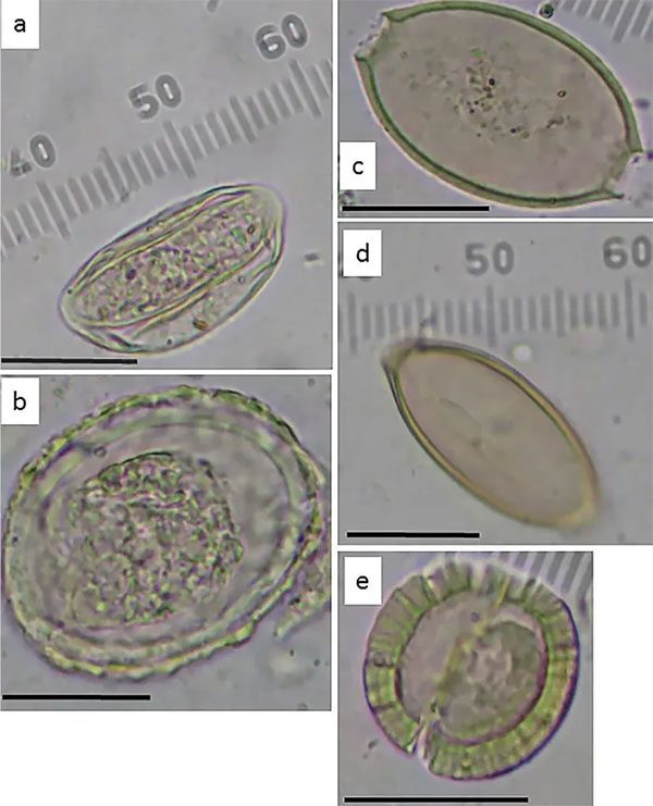 Parasite eggs