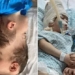 using virtual reality surgeons in uk and brazil successfully separate conjoined twins 122108