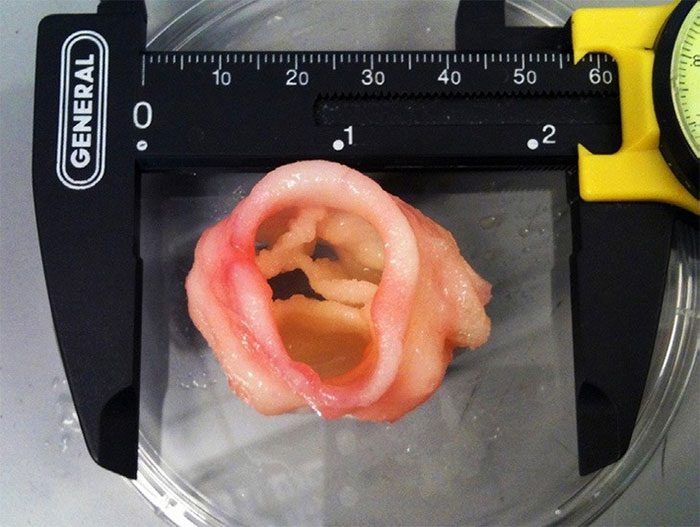 Heart valve printed using bioprinting technology.