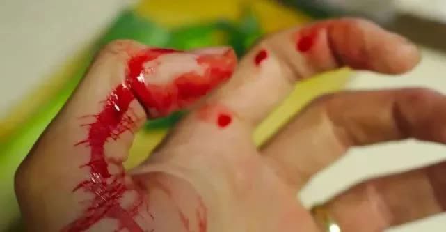 Wounds take longer to heal in low-oxygen environments.