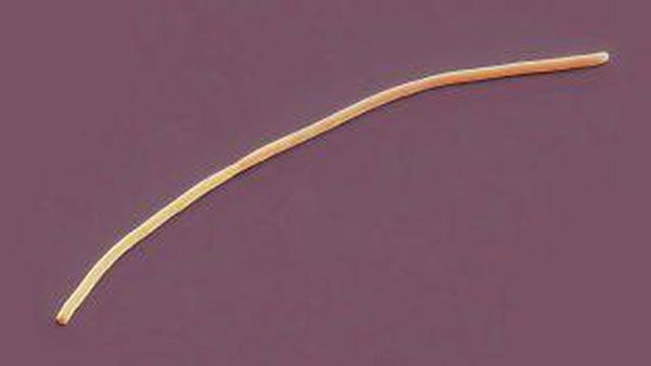A newly discovered bacterium can be up to 0.78 inches (2 cm) long. This image shows another bacterium with a similar long and slender shape.