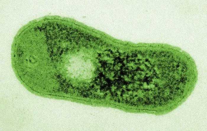 Microscopic image of Gemmatimonas phototrophica.