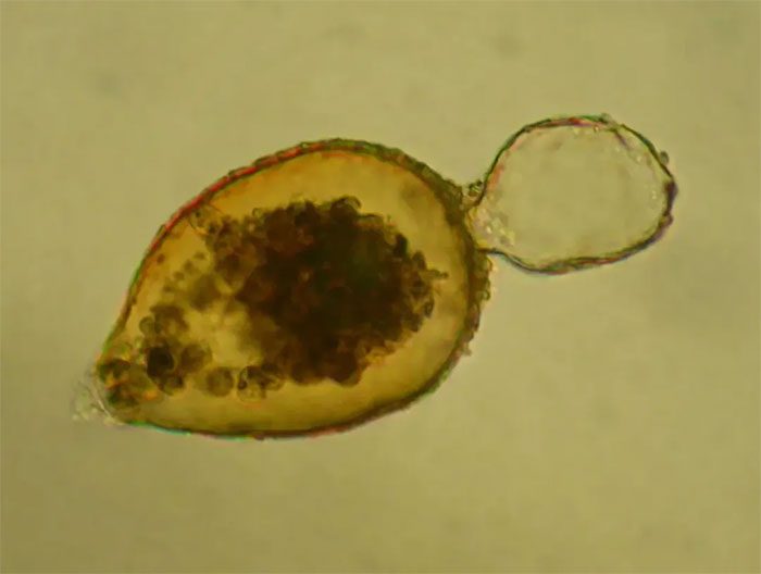 Resigella bilocularis under the microscope.