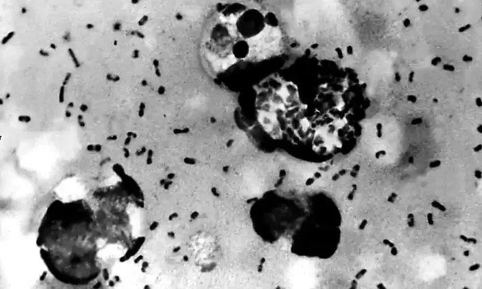 Plague bacteria taken from a patient in 2003.