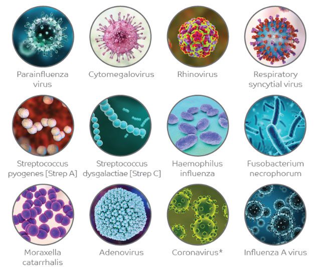 Some bacteria that cause acute pharyngitis.