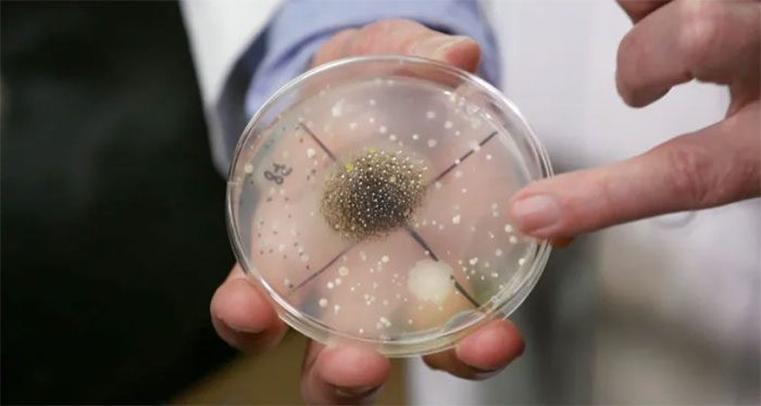 Bacteria and mold on the space station have hitchhiked with astronauts and supplies.