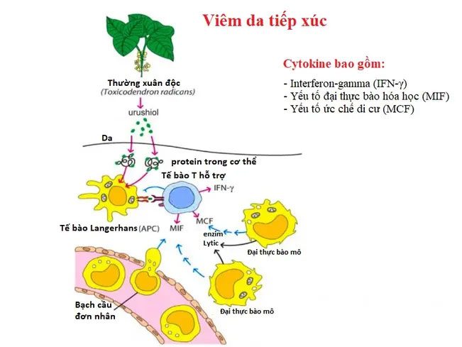 Delayed hypersensitivity reaction occurs when the body comes into contact with urushiol in poison ivy.