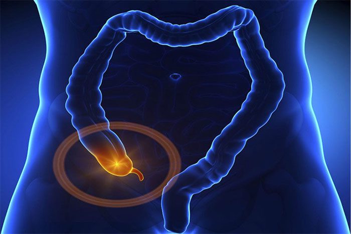 Intestinal inflammation is a cause of small bowel obstruction.