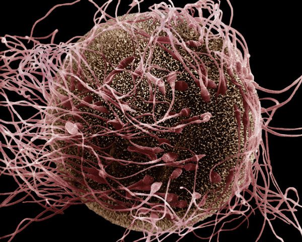 These traces are byproducts when a virus infects a cell
