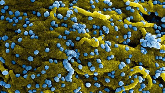 Colorized scanning electron microscopy image of Marburg virus particles (blue)