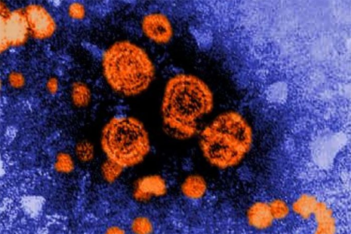 virus adeno 1