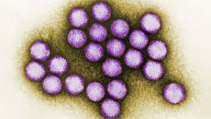 Adenovirus is the primary suspect in the early wave of mysterious hepatitis.