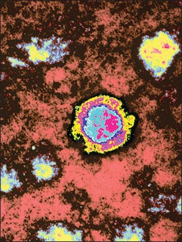 Borna virus under an electron microscope.