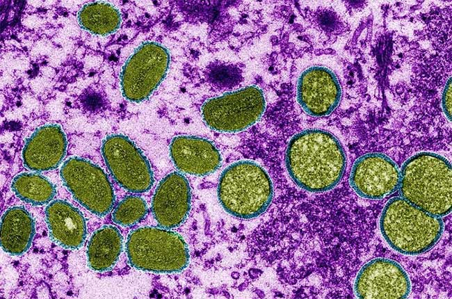 Monkeypox virus under a microscope.
